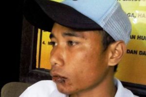 Ardi Korban aparat