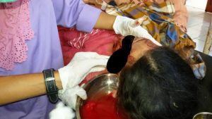 Kecelakaan parah