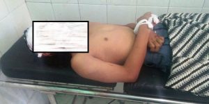 Korban kecelakaan 1