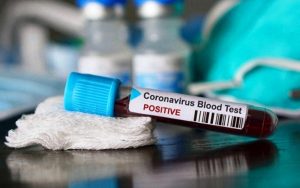 Positif Covid Seketeng