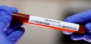 Swab Negatif
