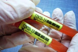 Virus Covid